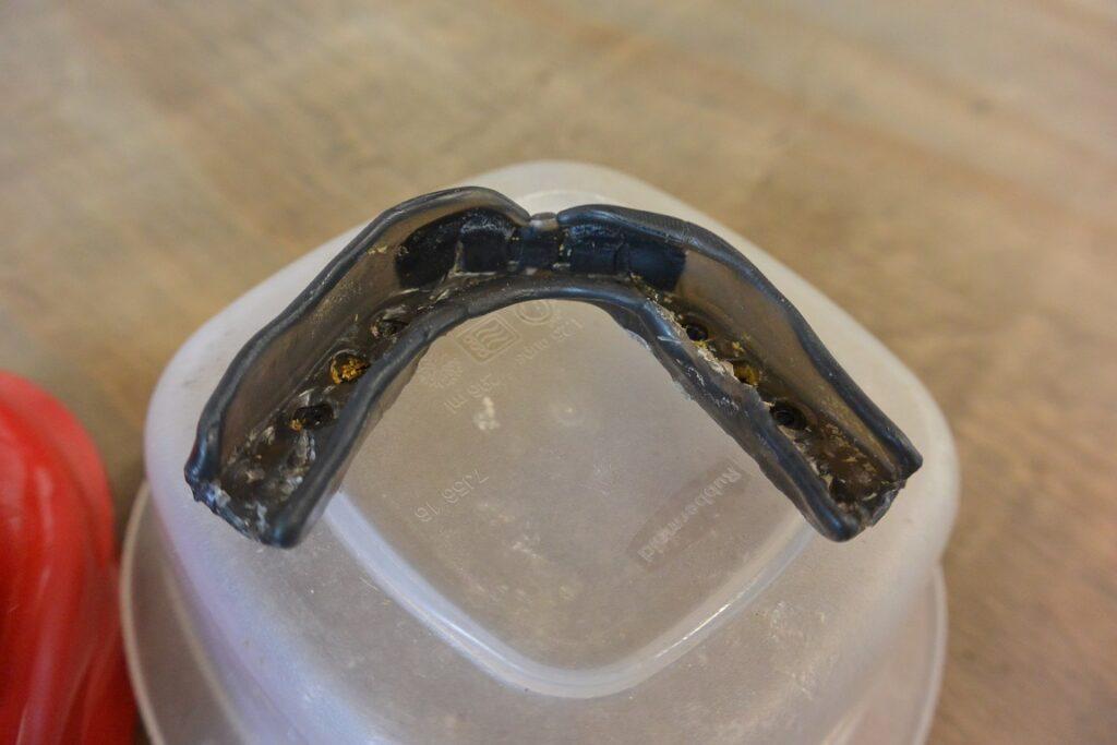 Impact customFIT - WAY Better Than Store Bought Mouthguards - 1+ Year Review 3 dsc 1698