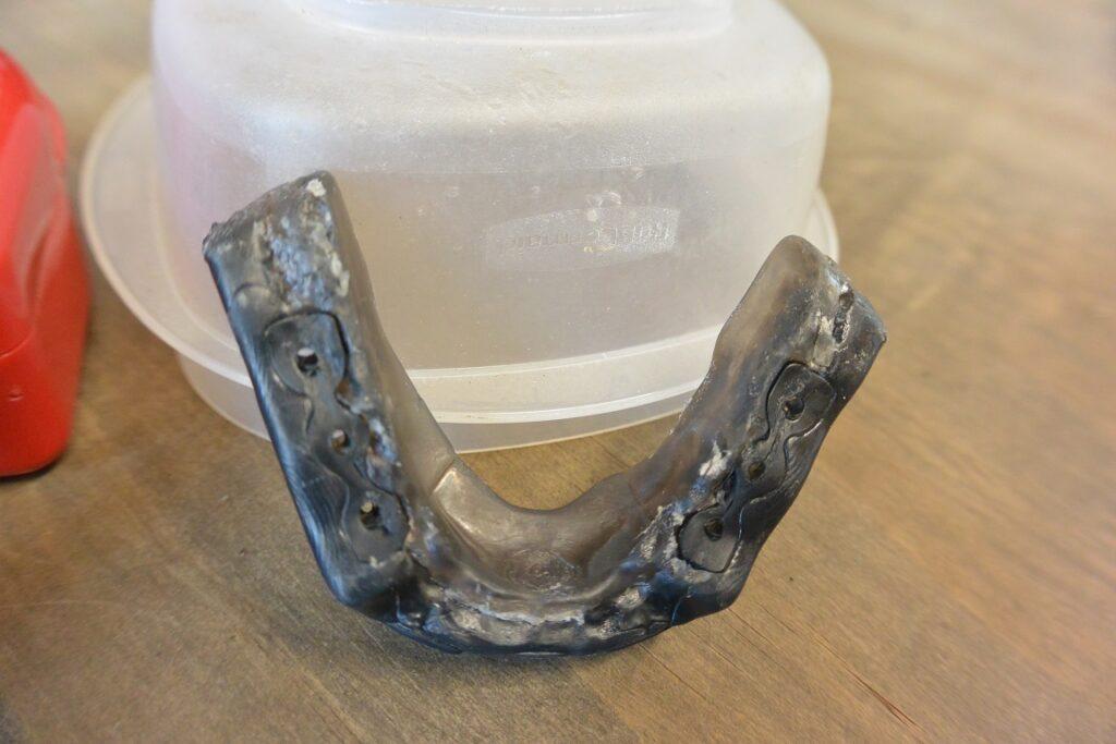 Impact customFIT - WAY Better Than Store Bought Mouthguards - 1+ Year Review 5 dsc 1701