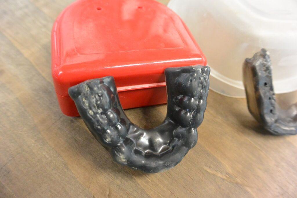 Impact customFIT - WAY Better Than Store Bought Mouthguards - 1+ Year Review 4 dsc 1702